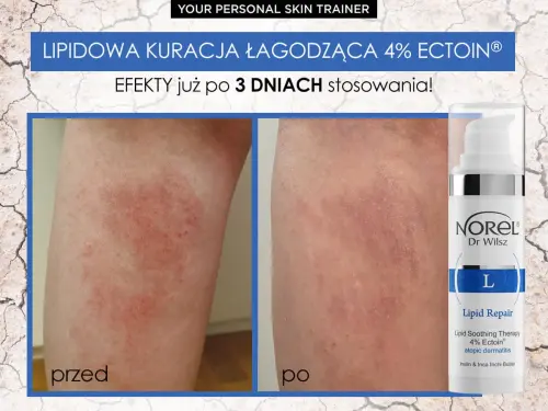 171739117_3978907812196343_6783464478479177975_n.jpg  Norel Lipid Repair  Kuracja Łagodząca  